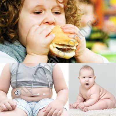 Причины детского ожирения.