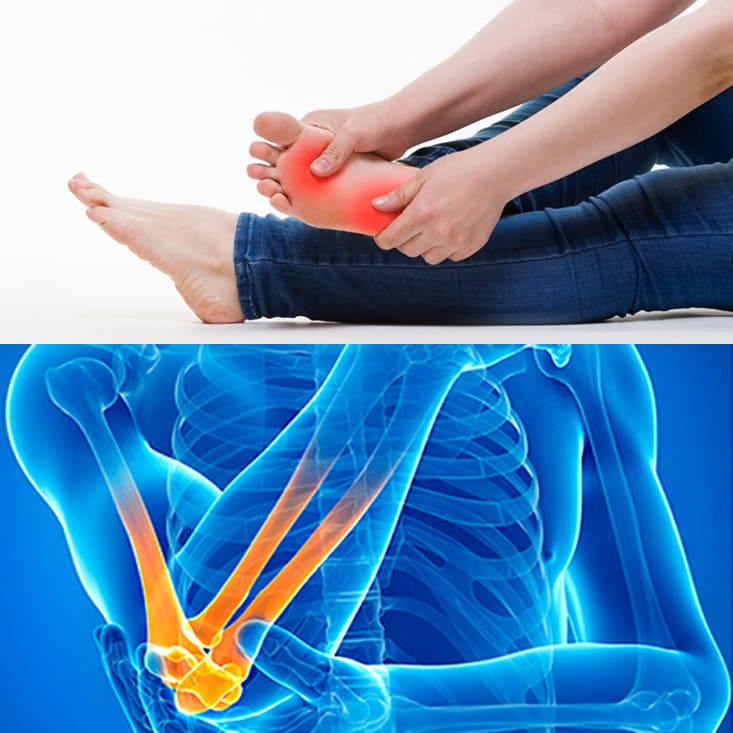 артрит суставов стопы лечение
